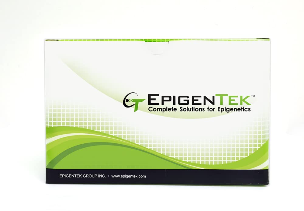 EpiQuik Global Acetyl Histone H4K5 Quantification Kit (Fluorometric) 